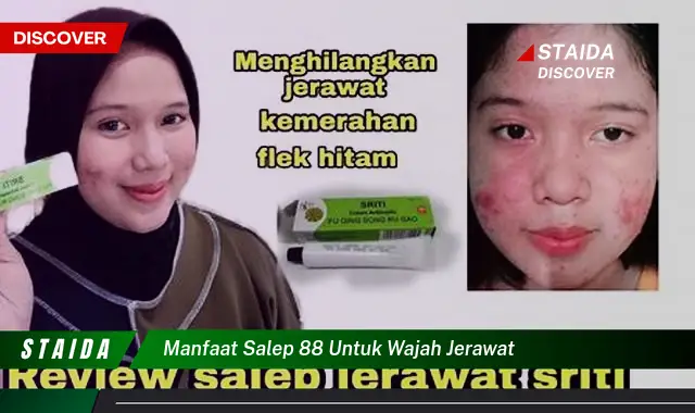 Temukan 7 Manfaat Salep 88 untuk Wajah Berjerawat yang Jarang Diketahui