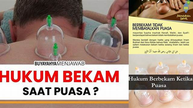 Apakah Boleh Bekam Saat Puasa