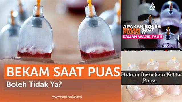 Boleh Bekam Saat Puasa