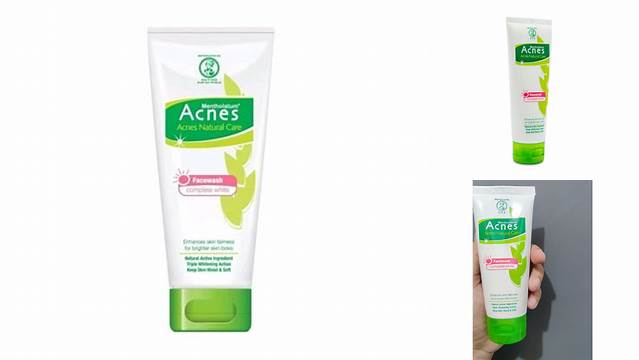 Temukan Beragam Manfaat Acnes Complete White yang Jarang Diketahui