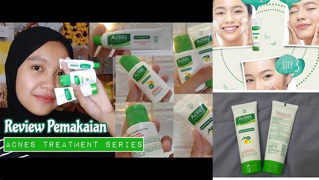 Manfaat Acnes Treatment Series yang Jarang Diketahui, Wajib Dicoba!