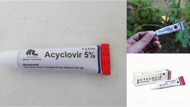 Temukan Manfaat Ajaib Acyclovir Salep: Rahasia Tersembunyi yang Wajib Diketahui