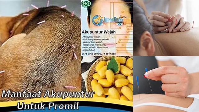 Manfaat Akupuntur Promil yang Jarang Diketahui