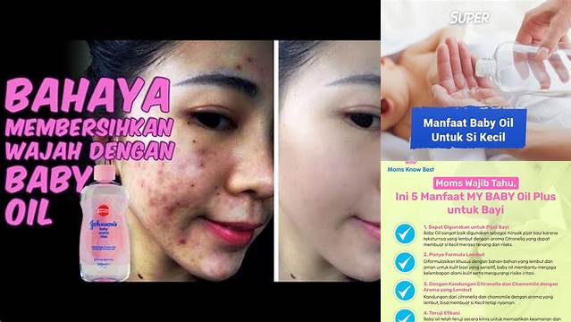 Temukan Rahasia Manfaat Baby Oil untuk Eksim