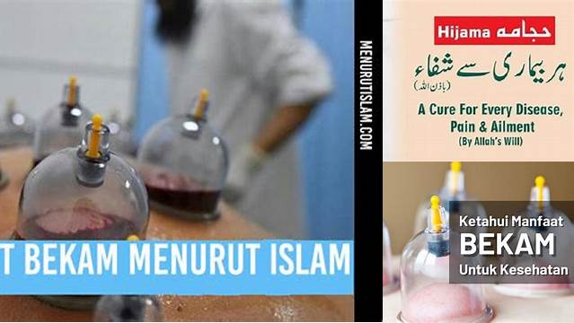 Temukan 7 Manfaat Bekam Dalam Islam Yang Jarang Diketahui