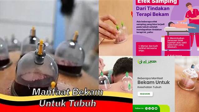 Ungkap 10 Manfaat Bekam yang Jarang Diketahui untuk Tubuh Anda