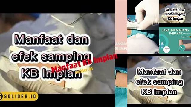 Temukan Manfaat KB Implan yang Perlu Anda Ketahui