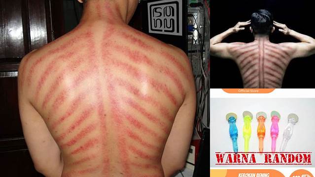 Temukan Manfaat Kerokan Punggung yang Jarang Diketahui