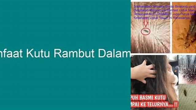 Temukan Manfaat Kutu Rambut dalam Islam yang Jarang Diketahui