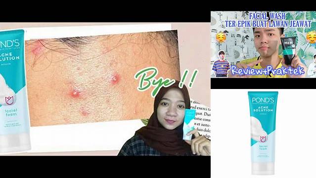 Temukan 10 Manfaat Ponds Acne Solution yang Jarang Diketahui