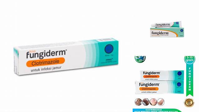 Temukan Manfaat Salep Fungiderm yang Jarang Diketahui