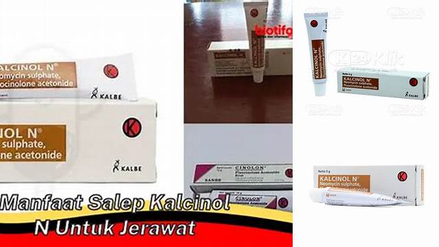 Temukan Khasiat Salep Kalcinol N untuk Jerawat yang Jarang Diketahui