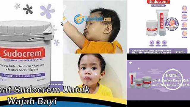 Temukan Manfaat Sudocrem untuk Wajah Bayi yang Jarang Diketahui
