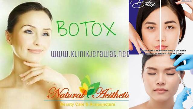 Temukan 5 Manfaat Suntik Botox yang Jarang Diketahui