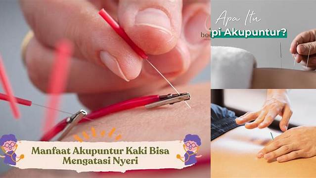 Manfaat Terapi Akupuntur yang Jarang Diketahui, Perlu Anda Ketahui
