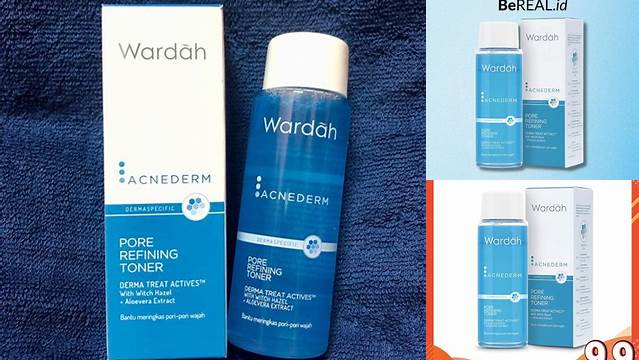 Temukan 8 Manfaat Toner Wardah Acnederm yang Jarang Diketahui