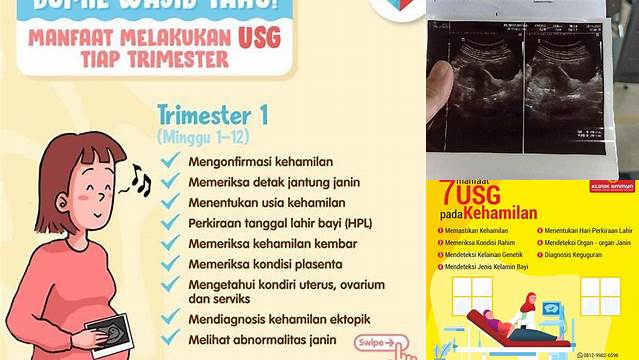 Temukan Rahasia USG Kehamilan yang Jarang Diketahui!