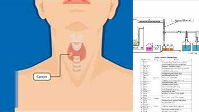 Temukan Berbagai Manfaat Radioisotop I-131 yang Jarang Diketahui